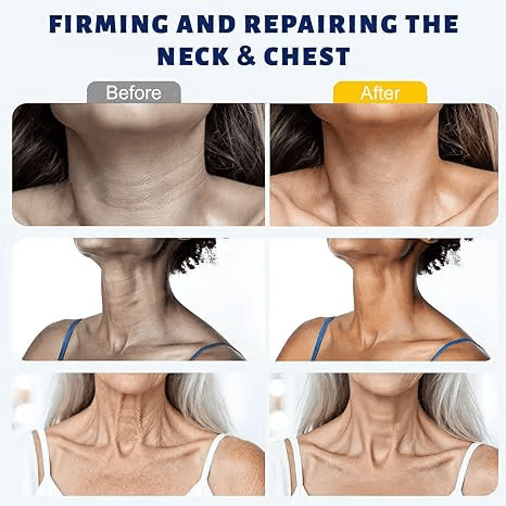 Lift & Tighten Neck Cream – Erase Wrinkles, Lines & Double Chin